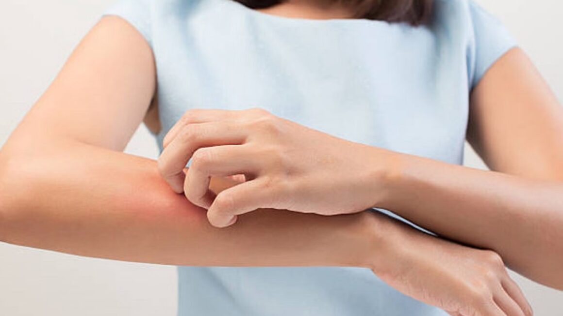 बदलते मौसम में स्किन पर खुजली और दानों से हैं परेशान, तो इन घरेलू नुस्खों से पाएं राहत