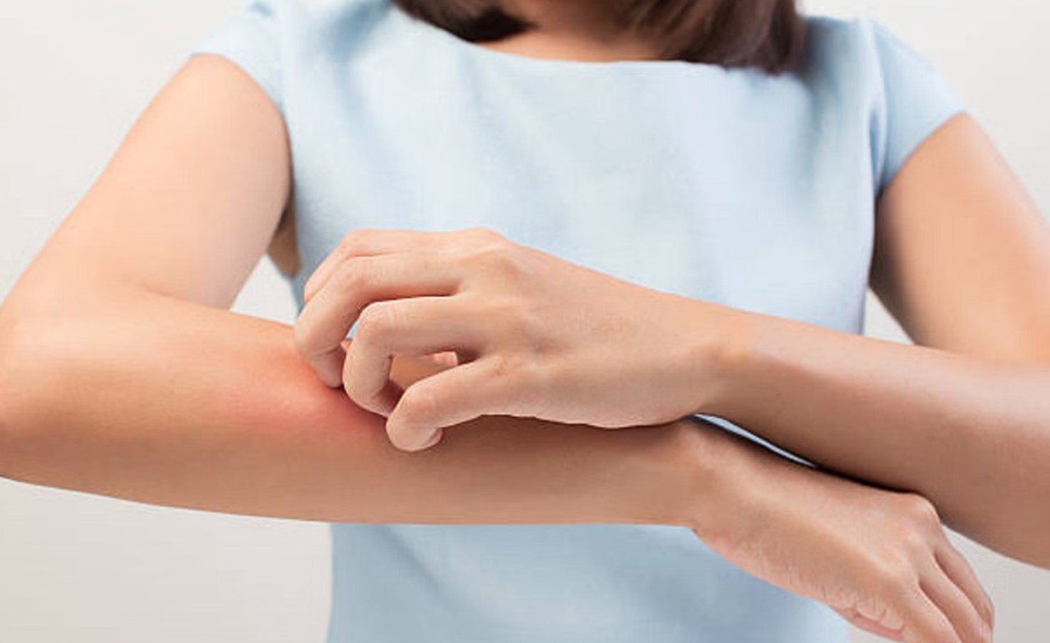 बदलते मौसम में स्किन पर खुजली और दानों से हैं परेशान, तो इन घरेलू नुस्खों से पाएं राहत